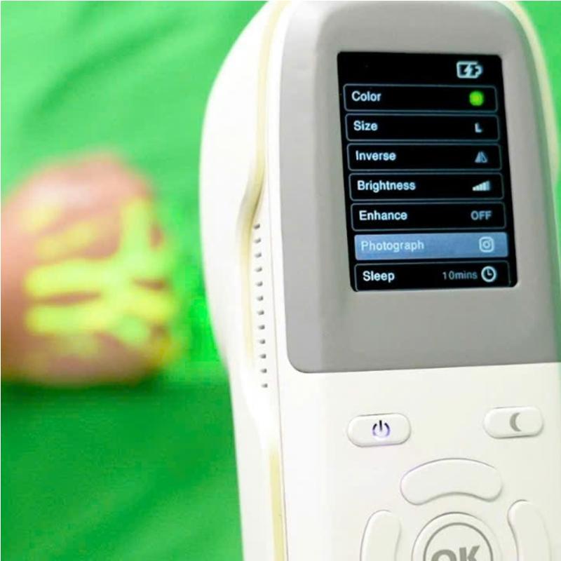 MÁY SOI TĨNH MẠCH