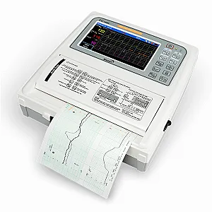 MONITOR THEO DÕI SẢN KHOA ĐÔI