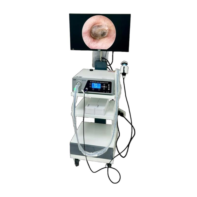 HỆ THỐNG MÁY SOI TAI MŨI HỌNG